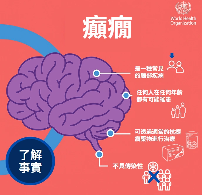 癲癇